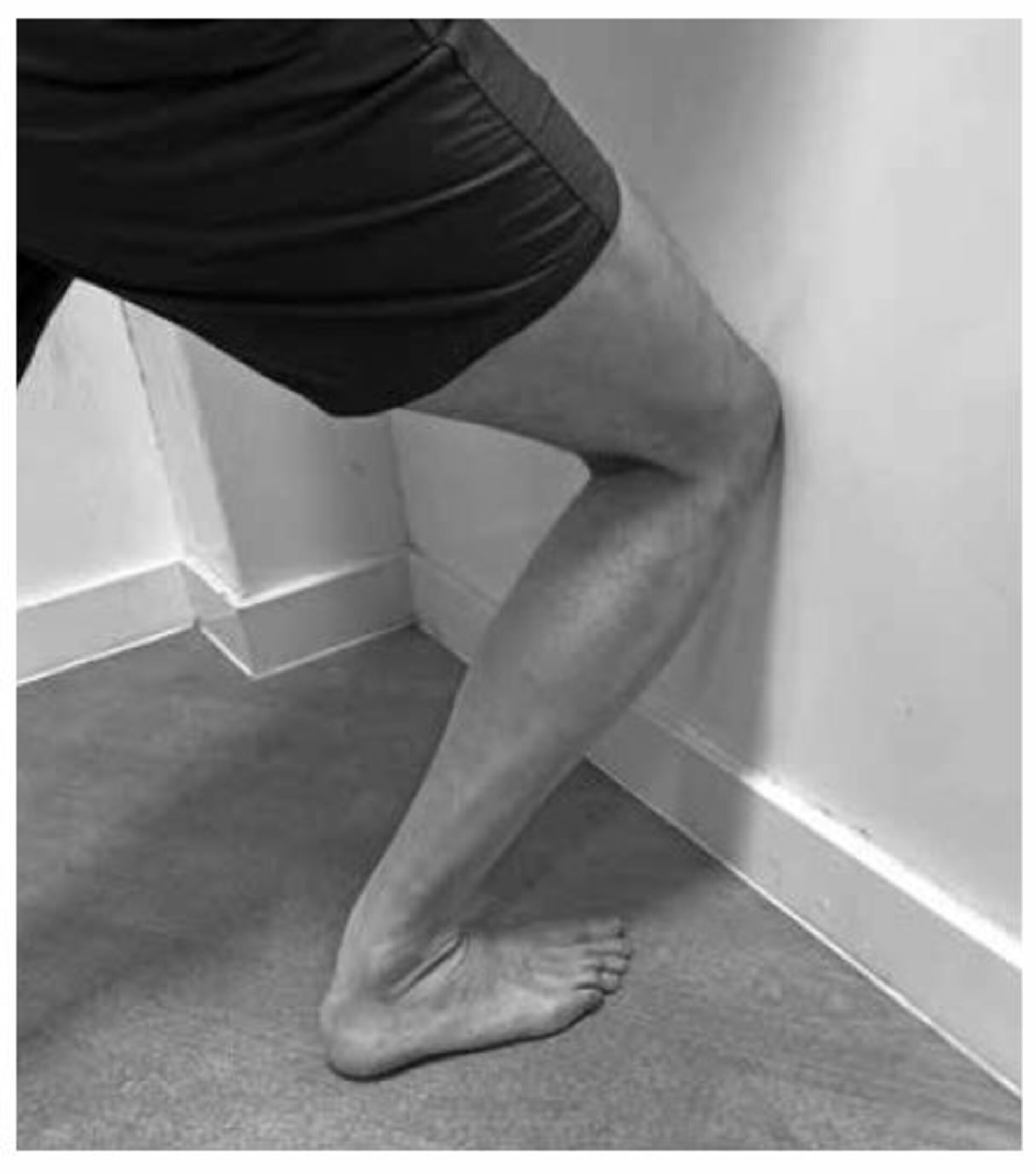 Soleus muscle