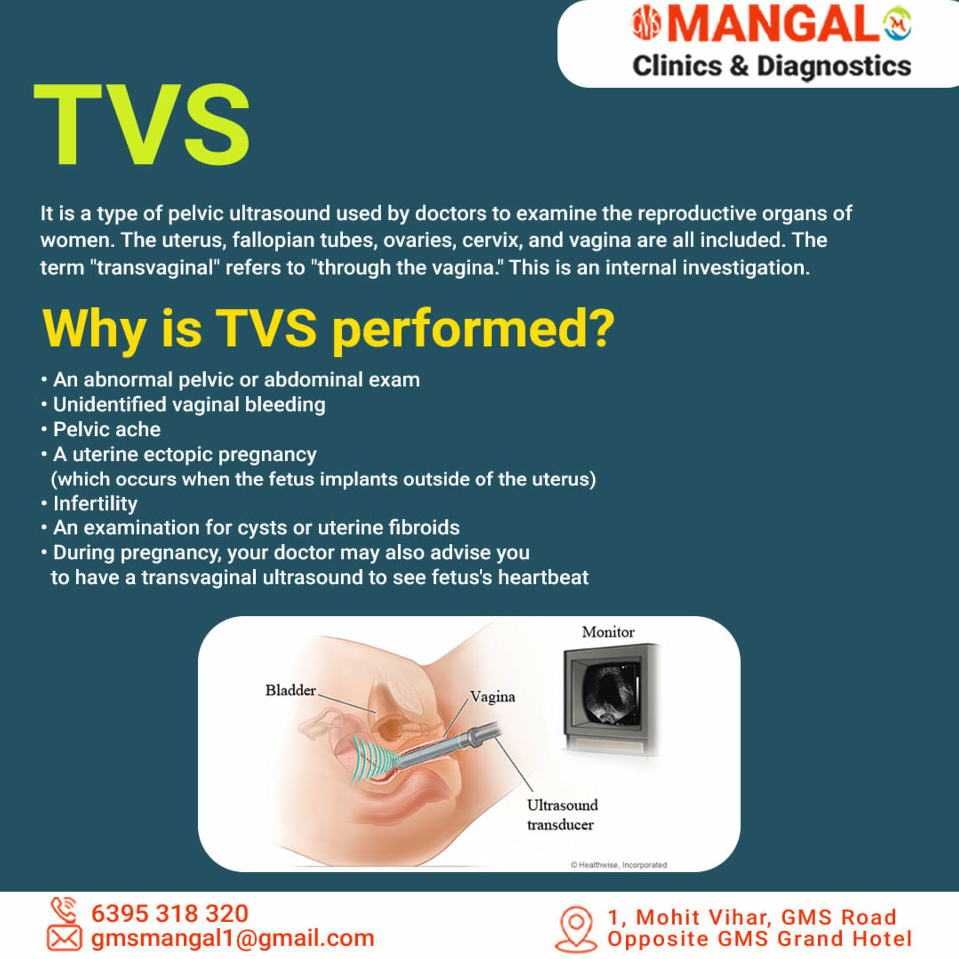 Understanding Transvaginal Ultrasound (TVS) | Dr. Deepti Agarwal