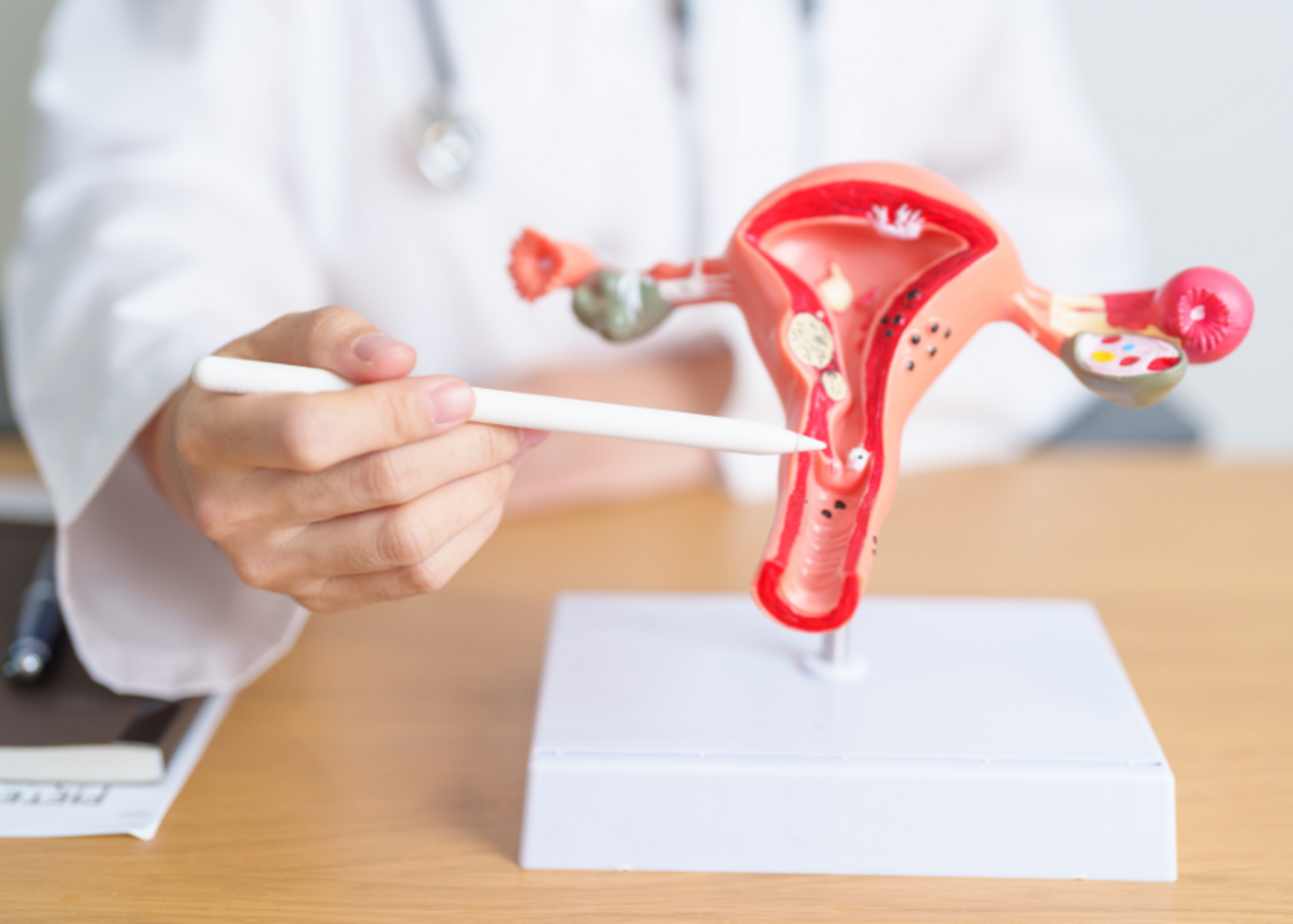Polycystic Ovary Syndrome (PCOS) Treatment | Dr. Afshan Maniyar