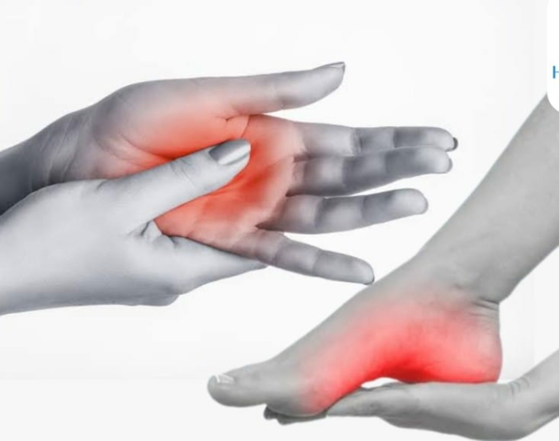 peripheral neuropathy | Dr. Siddharth Arora