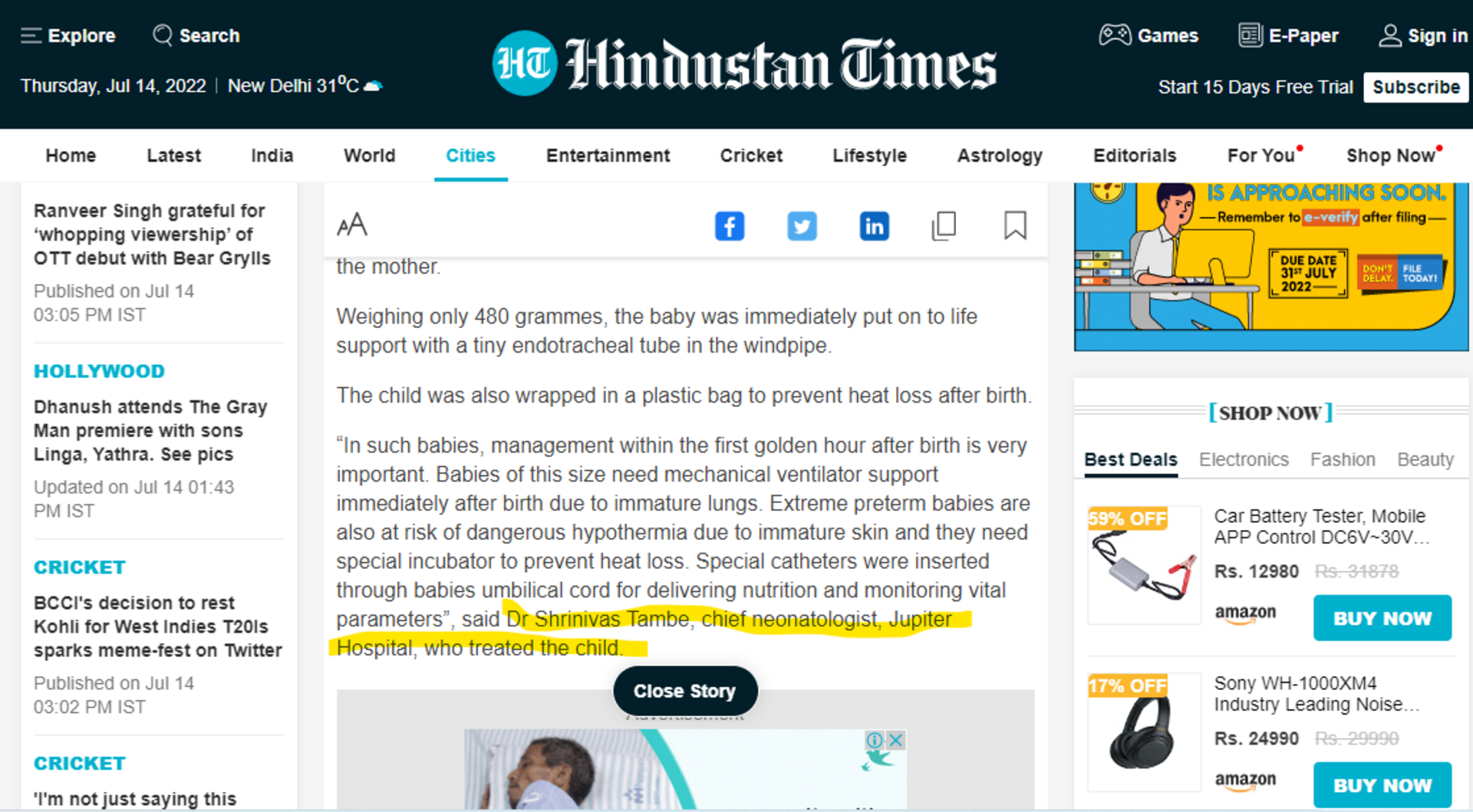 Premature child weighing 480 gm born in Pune