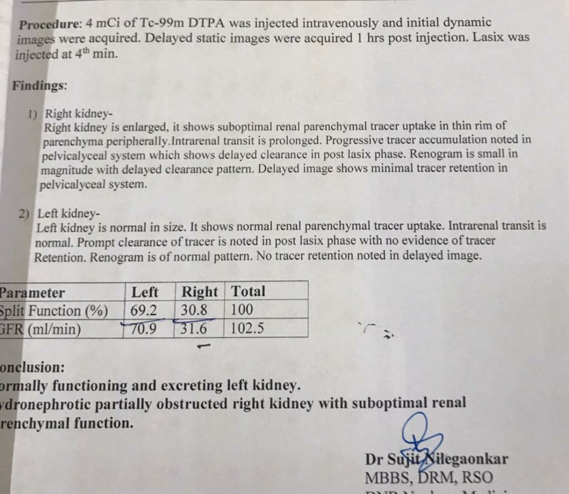 Abdomen Pain Caused by PUJ Obstruction Treated by 3D Laproscopic Pyeloplasty | Dr. Boopat Bhati