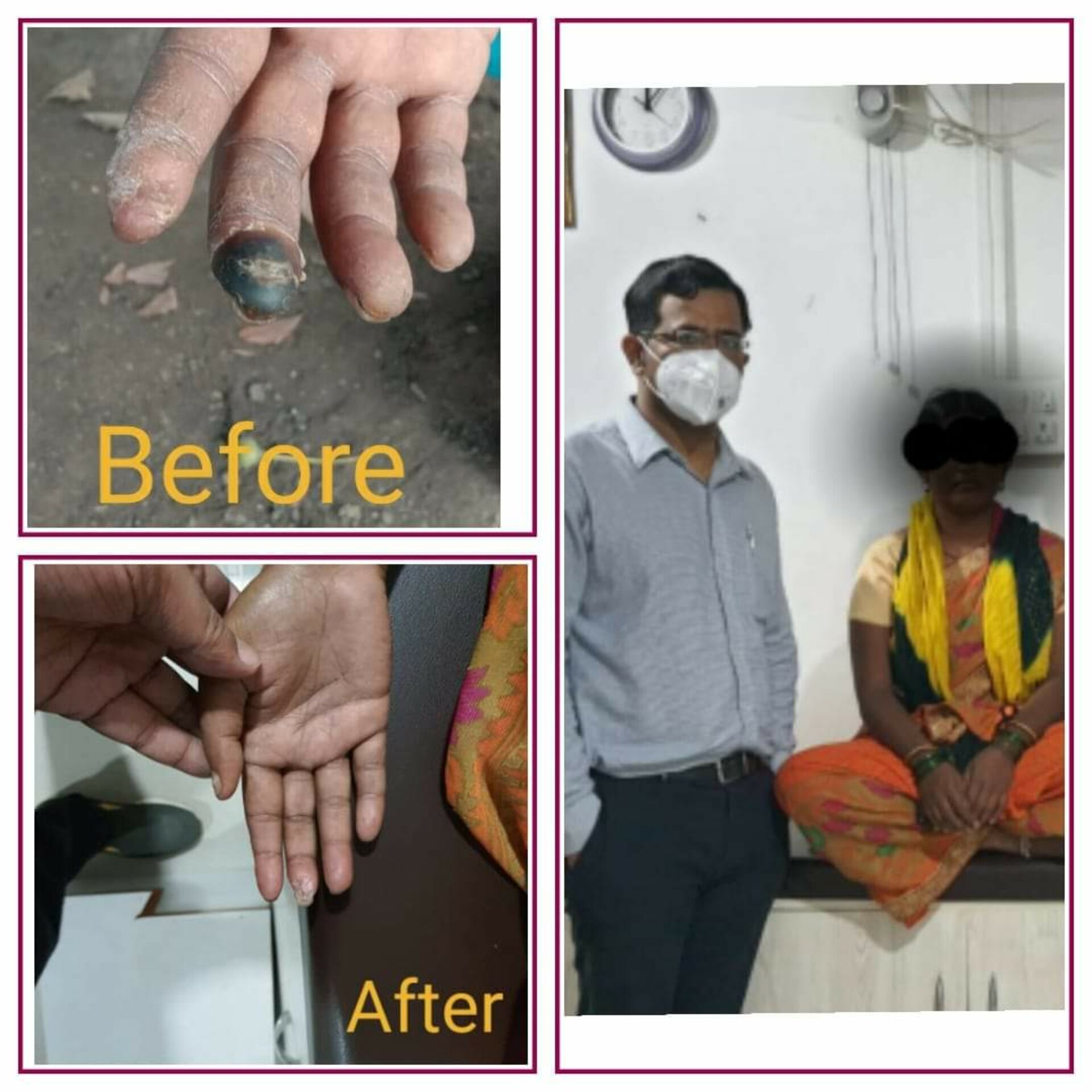 Case study of Patient - Dr. Yogesh Jamage