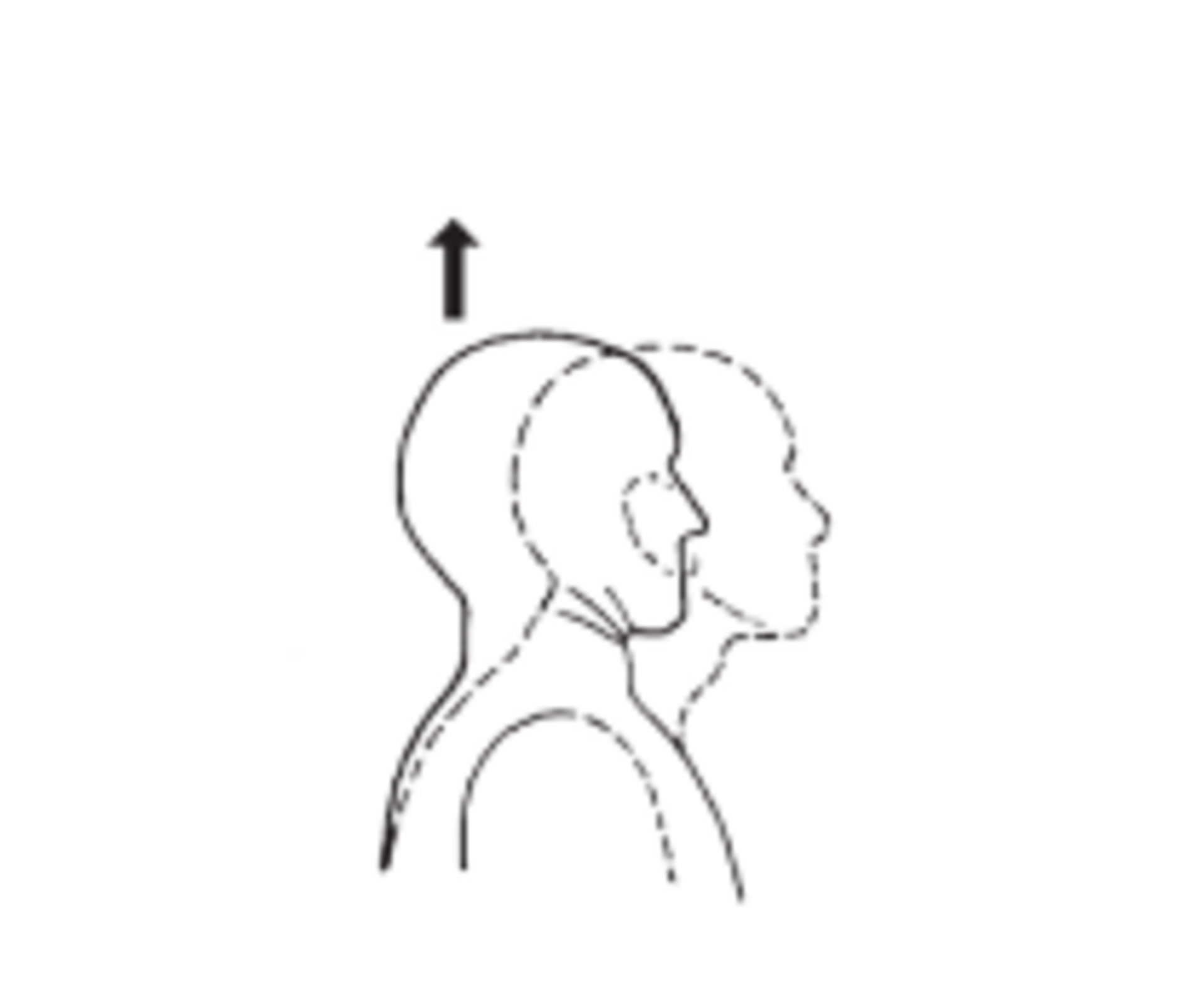 Chin Tucks