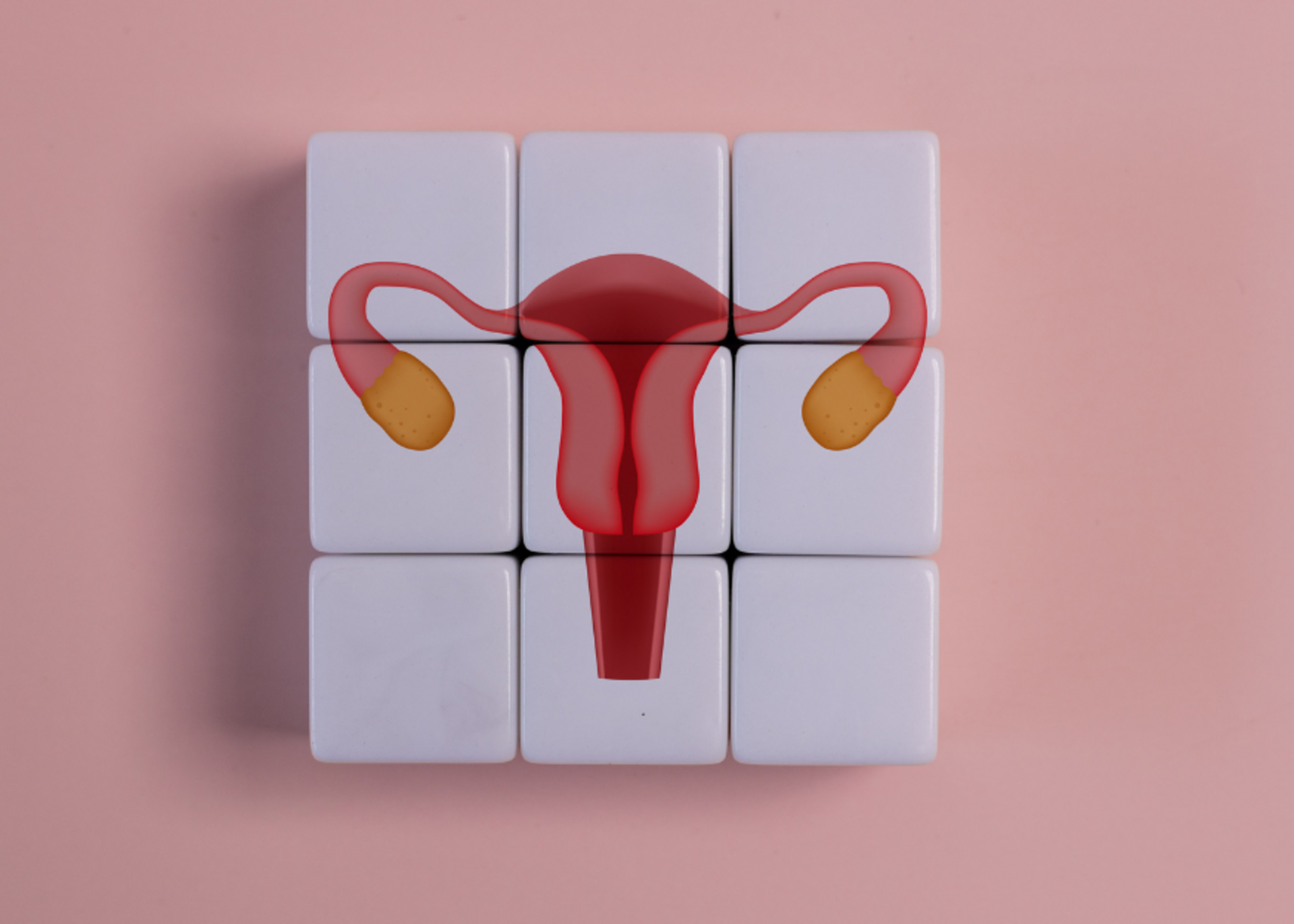 PCOS-Related Infertility | Dr. Akshay Chounde