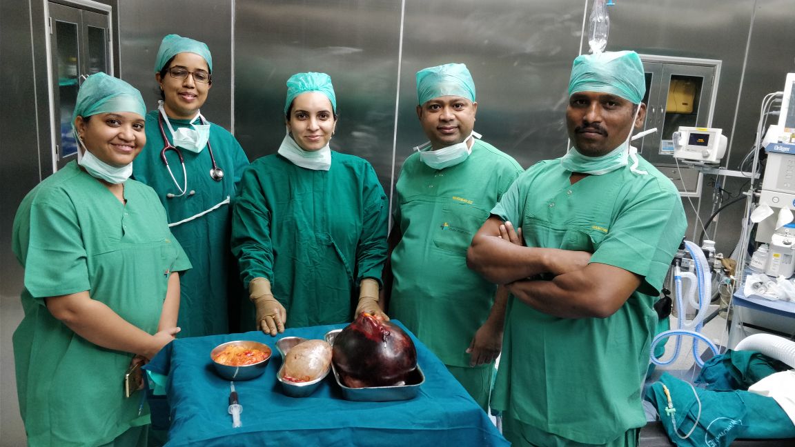 Giant ovarian tumor treatment|ARCUS HOSPITAL|Wanowrie,Pune