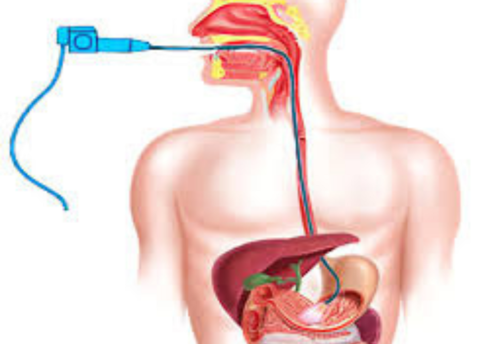 gastroscopy