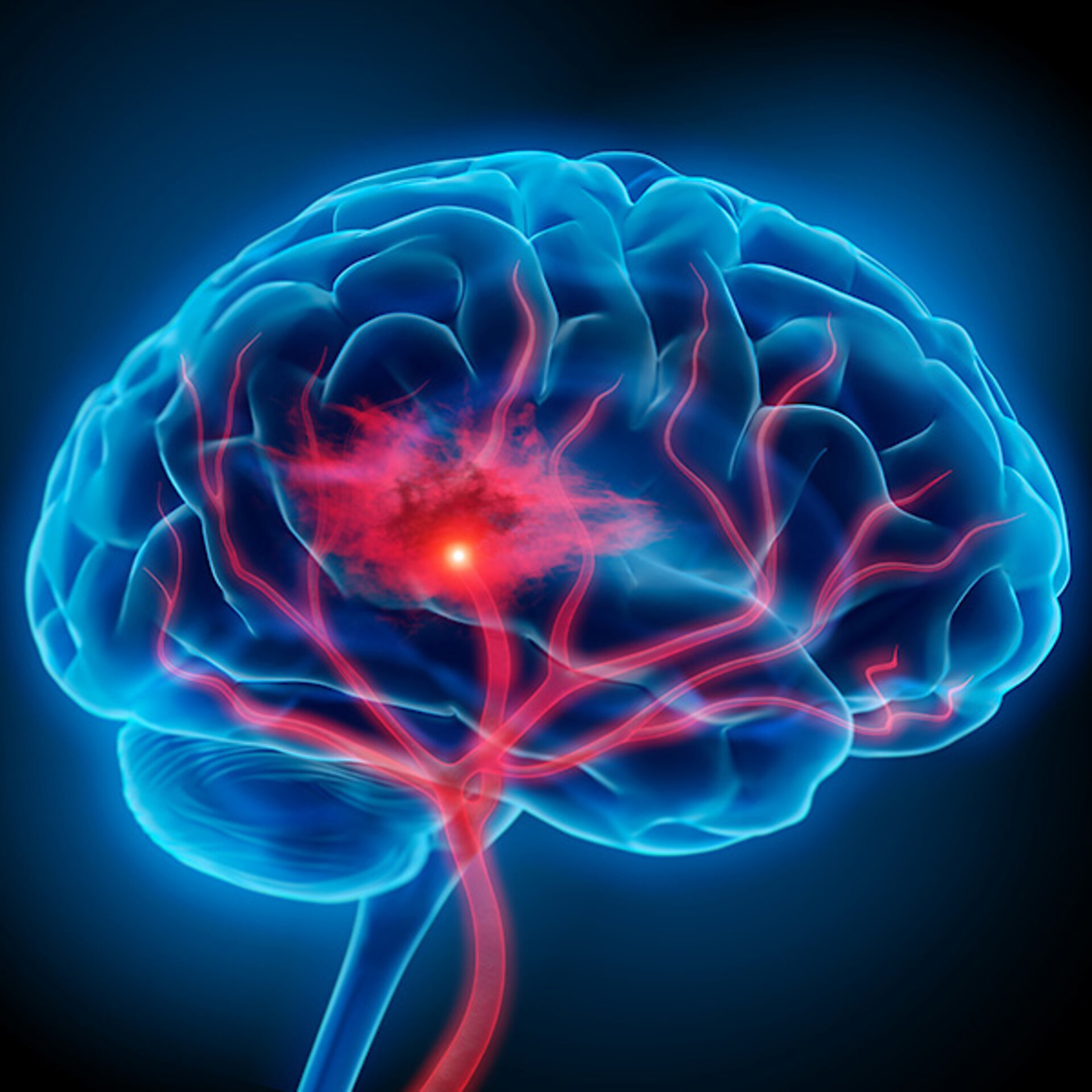 Neurovascular surgery
