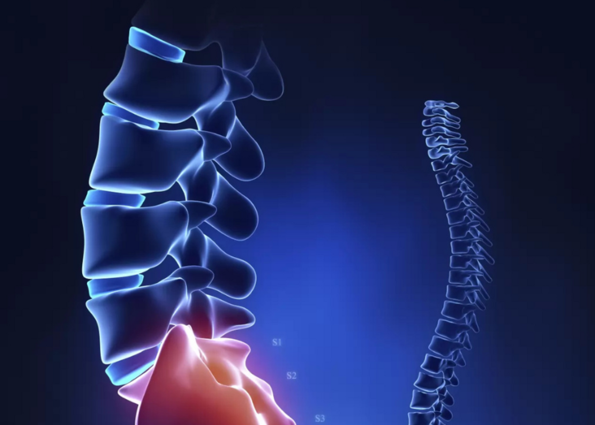 Coccygodynia | Dr. Manas Manohar
