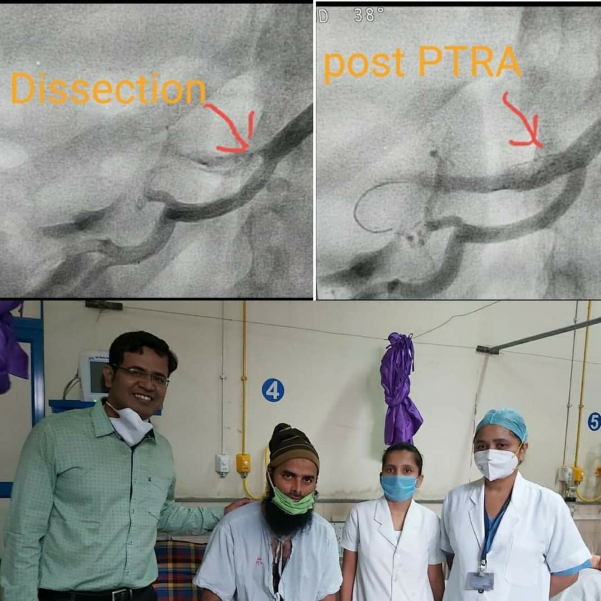 Rare case with rare presentation in COVID-19 pandemic