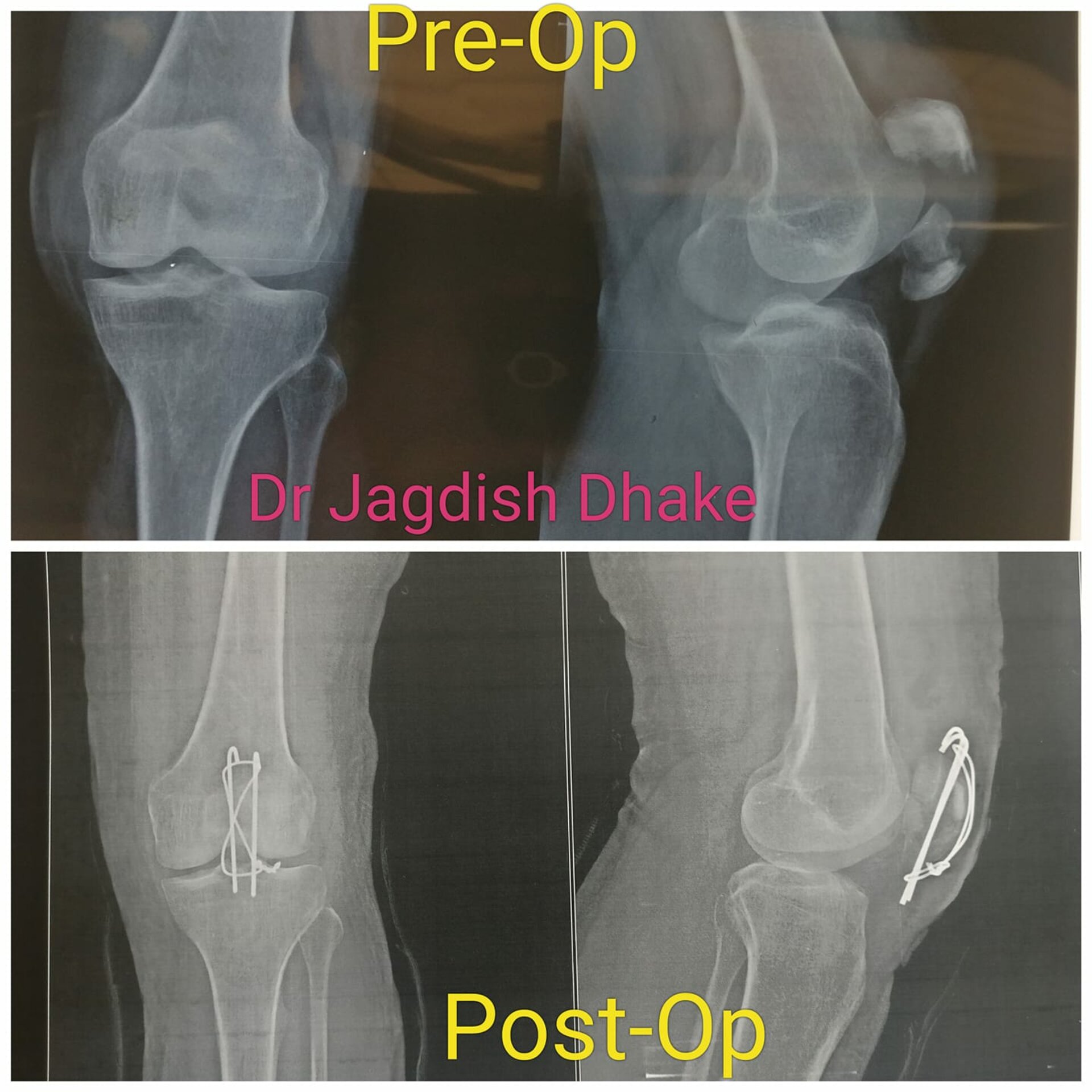 Happy Patient, Happy Us - Dr. Jagdish Dhake