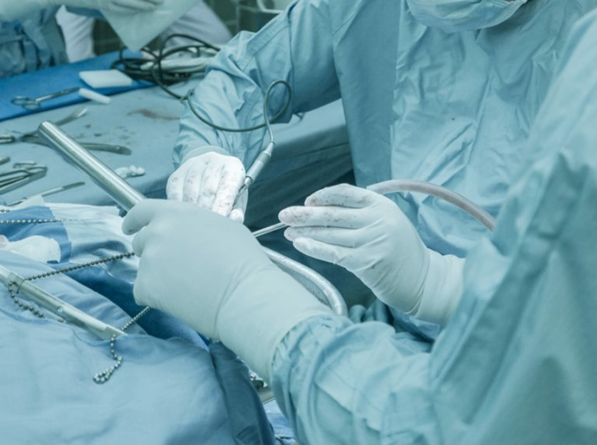 neuroendoscopy