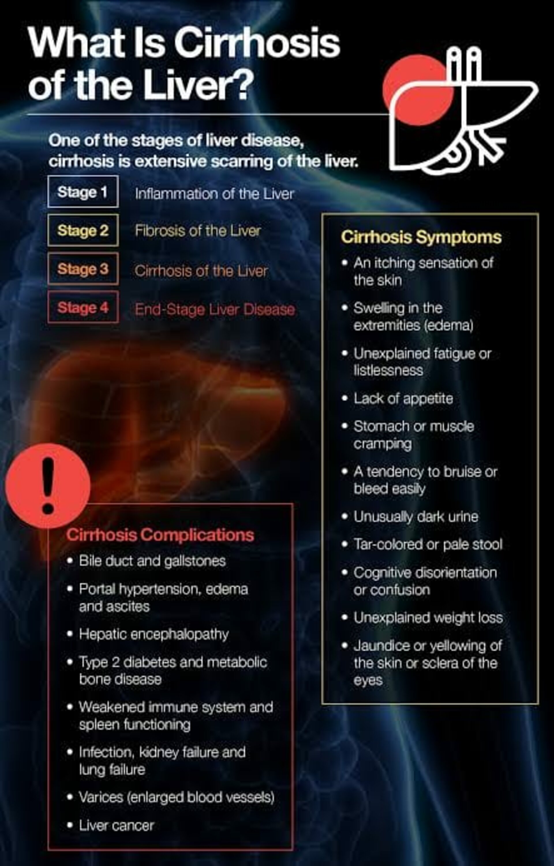 liver cirrhosis symptoms