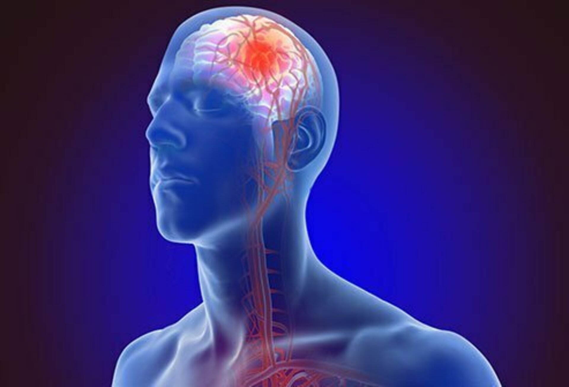 Surgery for Stroke Prevention |Dr. Advait Kothurkar