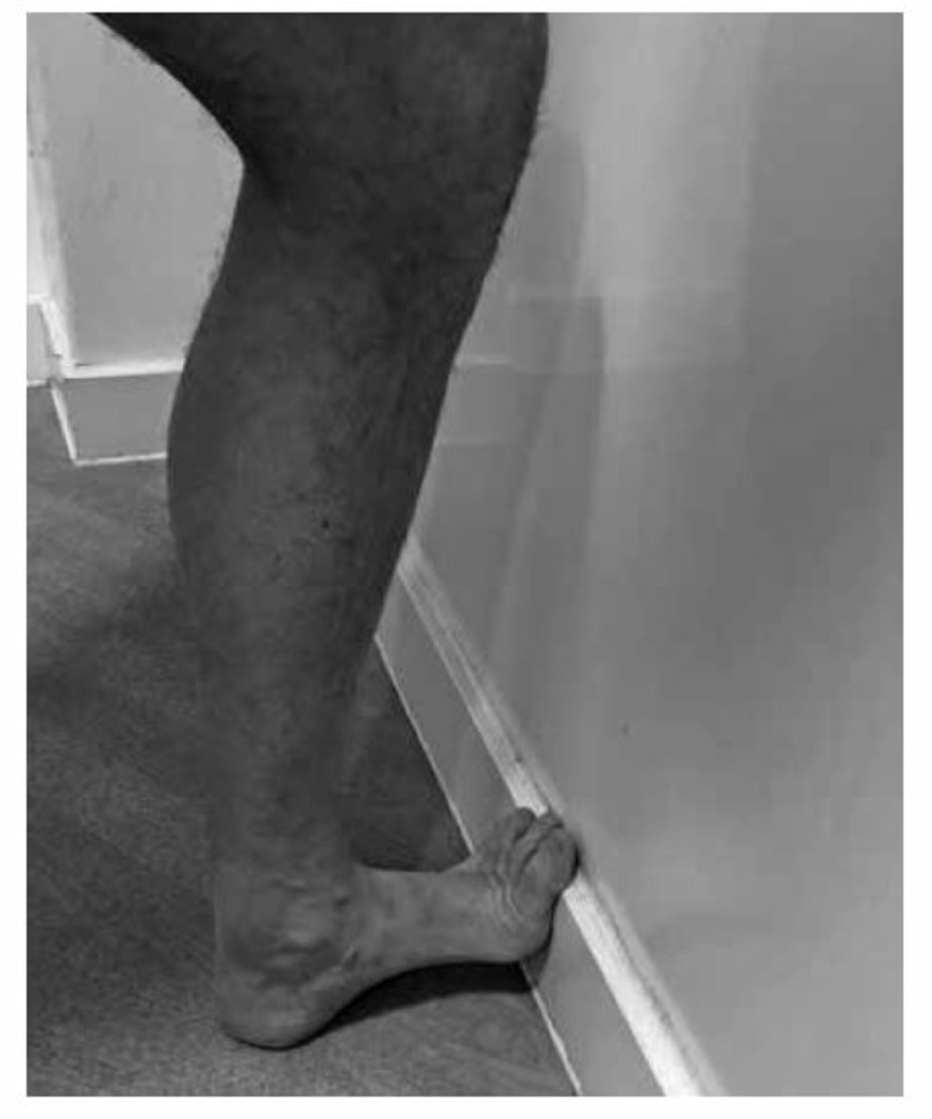 Plantar Fascia – Standing