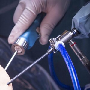 Arthroscopy