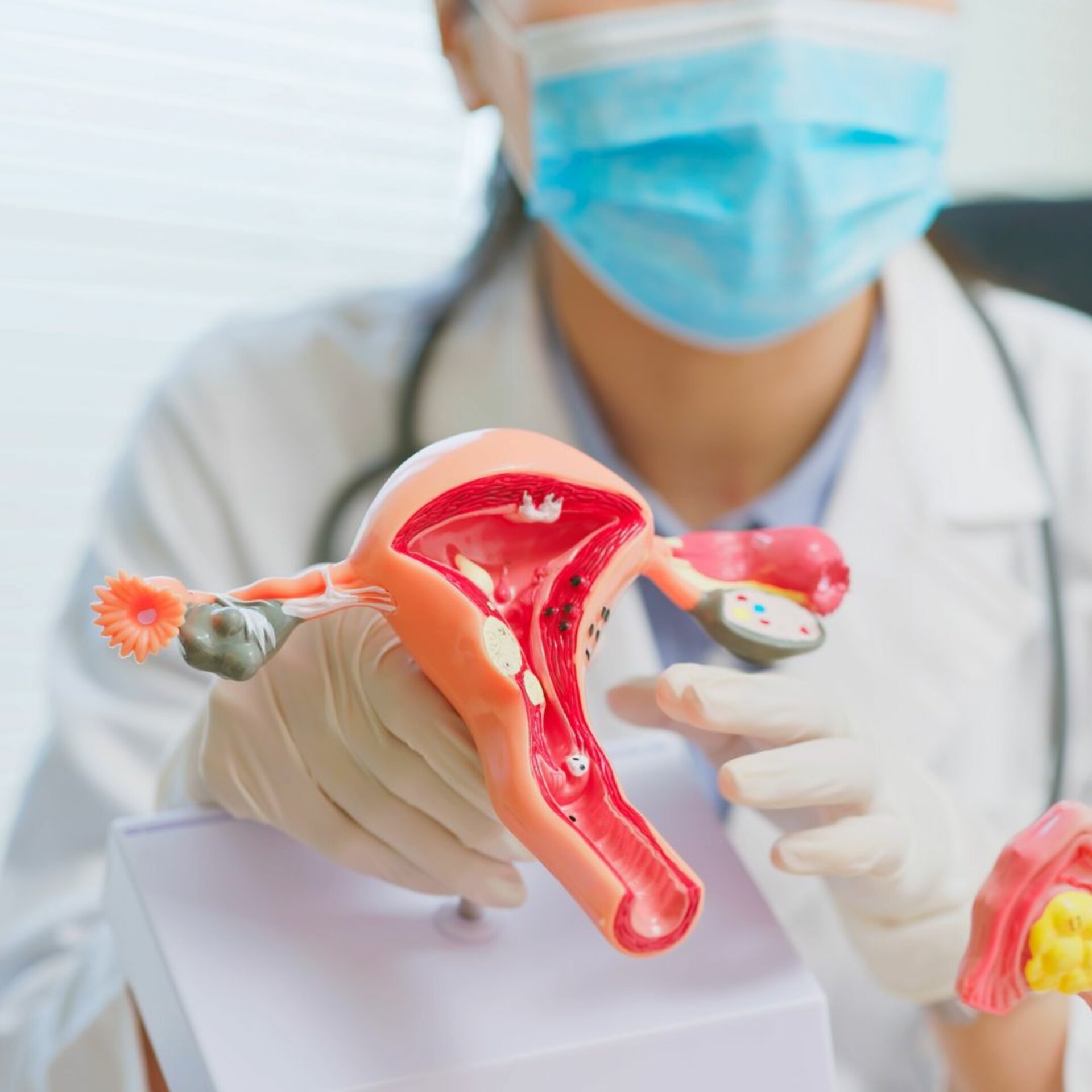 pcos treatment in wadgaonsheri pune