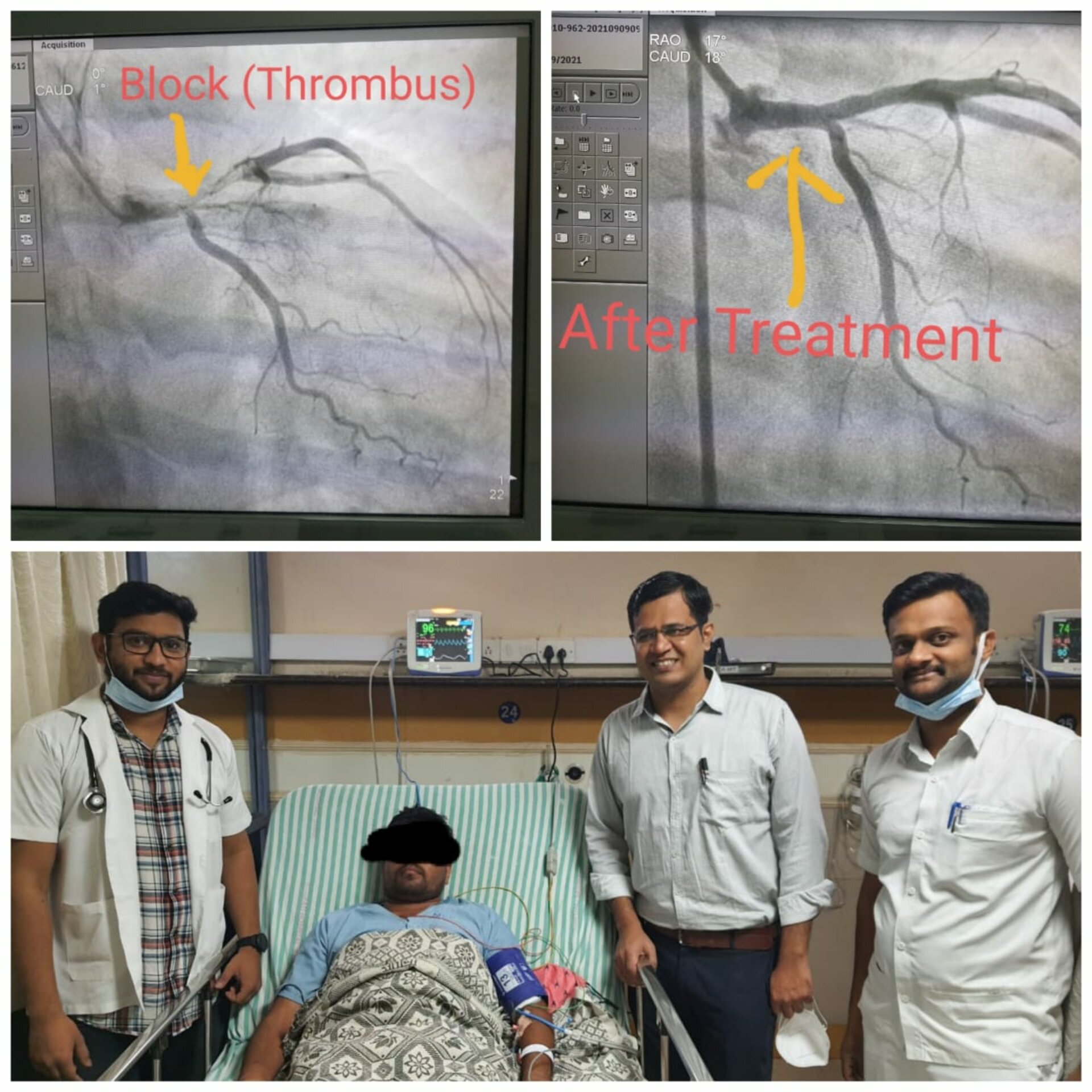 Sometimes Angioplasty is not a solution because Every Life Matters