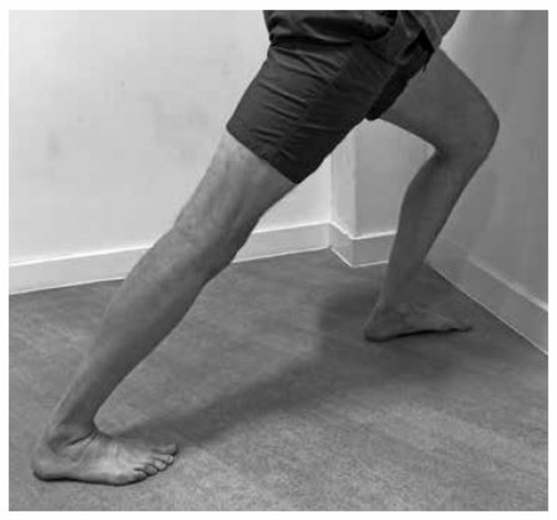 Gastrocnemius muscle