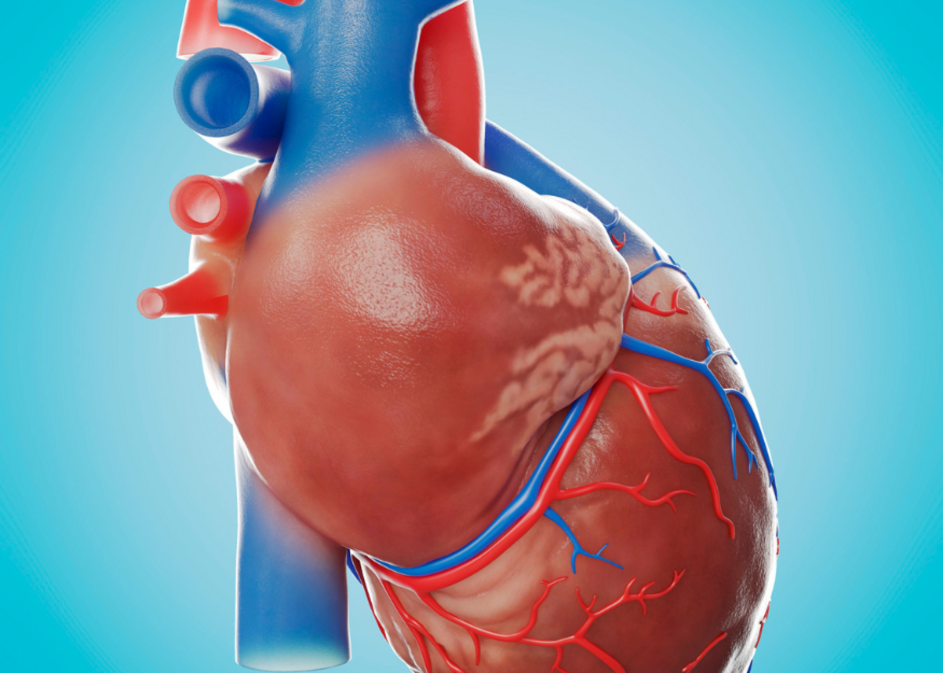 Pulmonary Vein Blockage Removal | Dr. Mehul Rathod