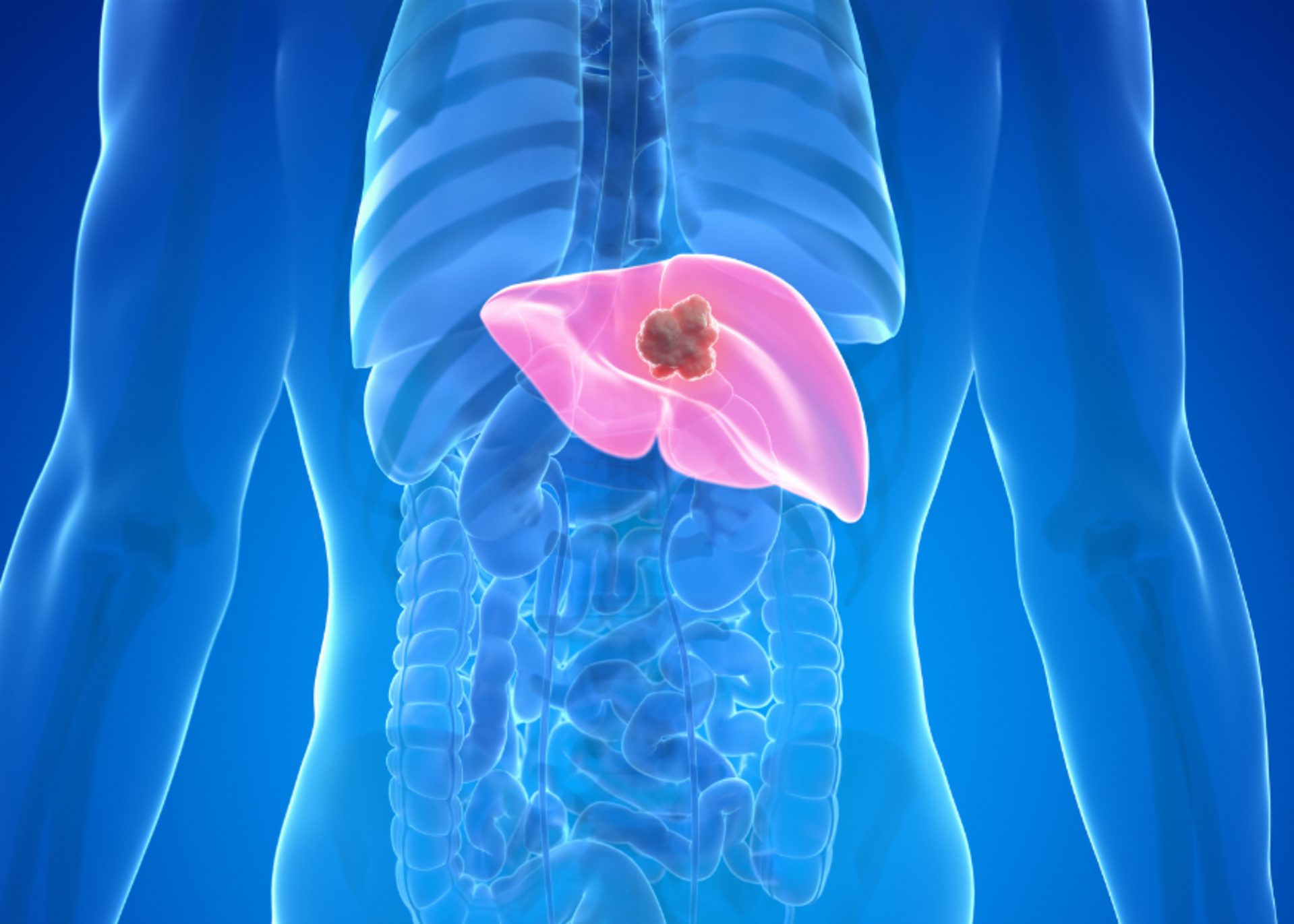 Liver Diseases by Dr. Rupesh Lunkad