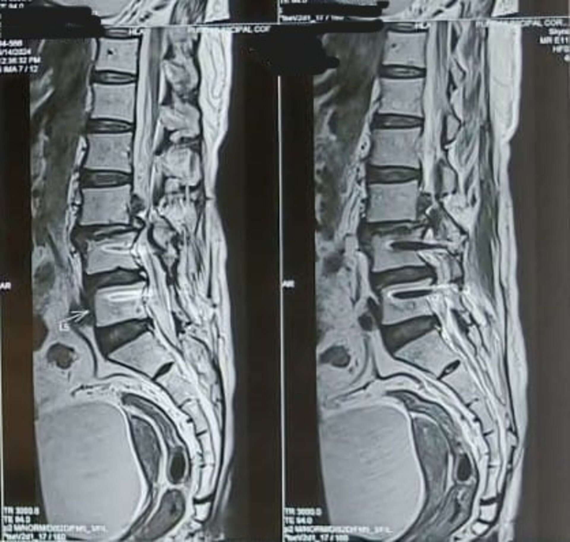 d6fad1783914d26f24983c16993ad04074d77624662ce70984b7d.jpeg?size=500&type=posts