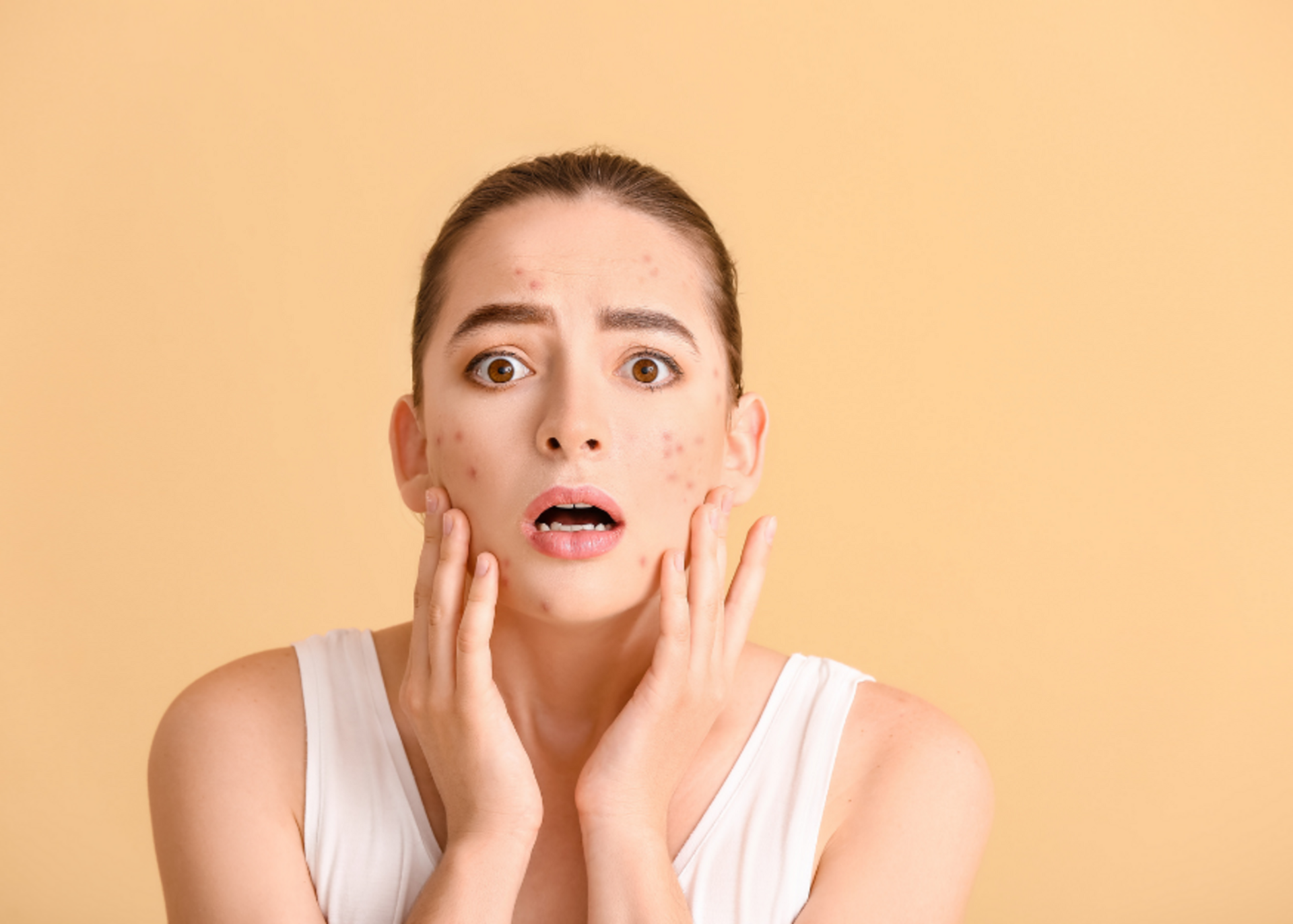 Acne Treatment | Dr. Sandhya Hippargekar