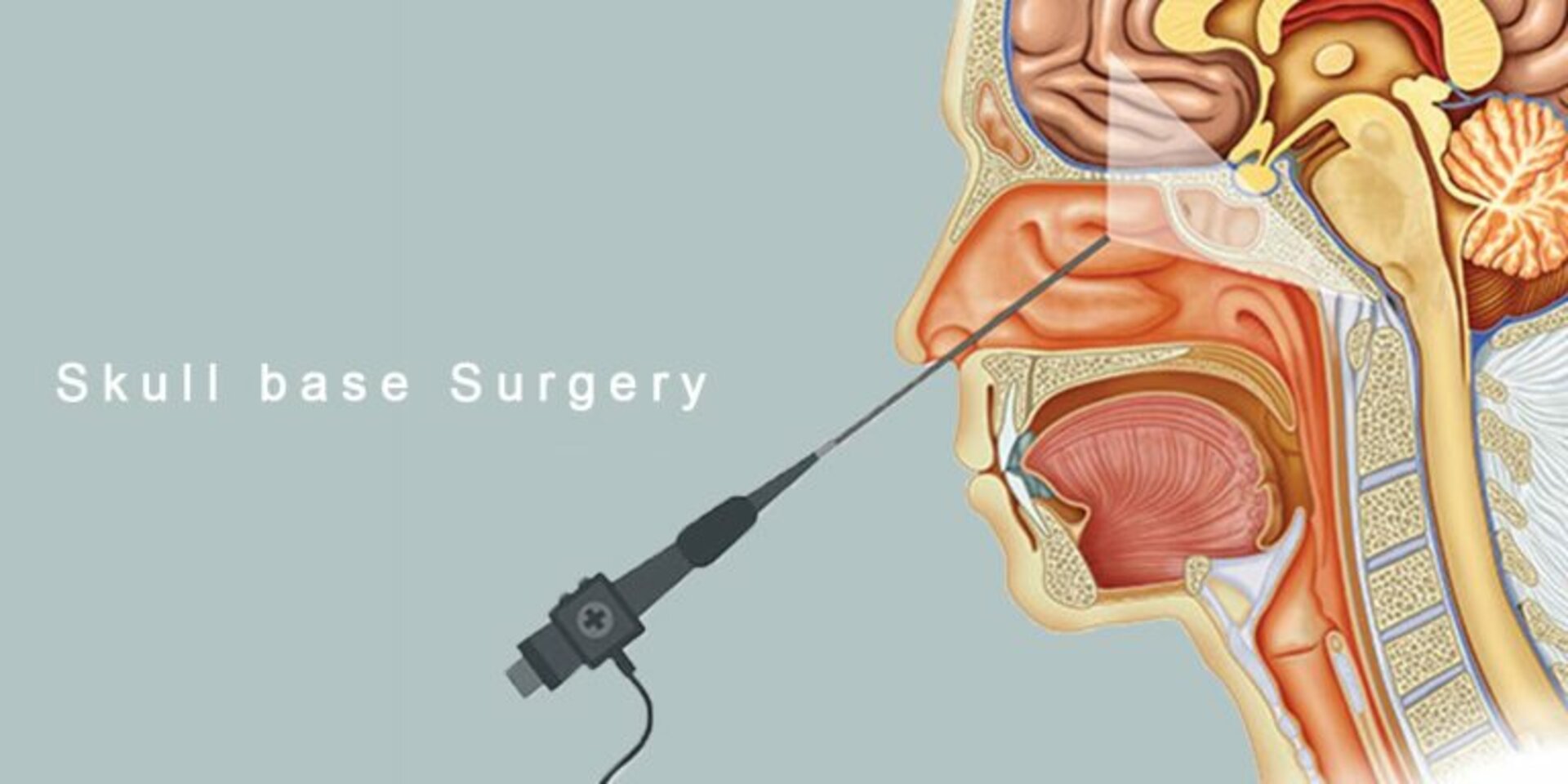 skull base surgery
