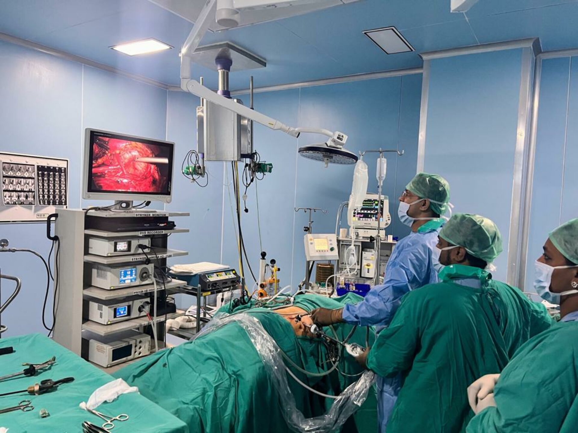 Abdomen Pain caused by PUJ Obstruction by Laparoscopic Pyeloplasty | Dr. Bhoopat Bhati