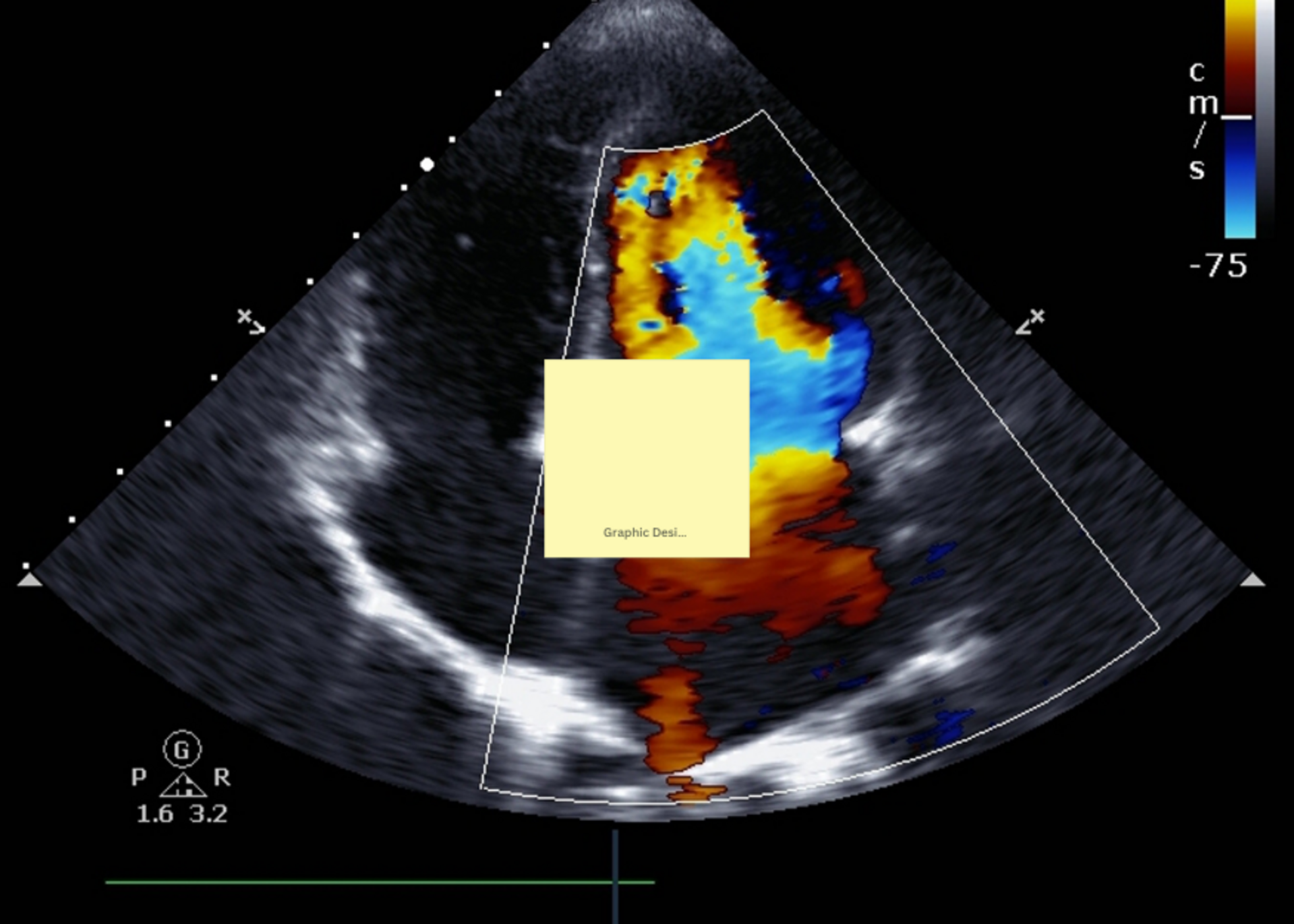 What is a Colour Doppler Ultrasound? | Dr. Deepti Agarwal